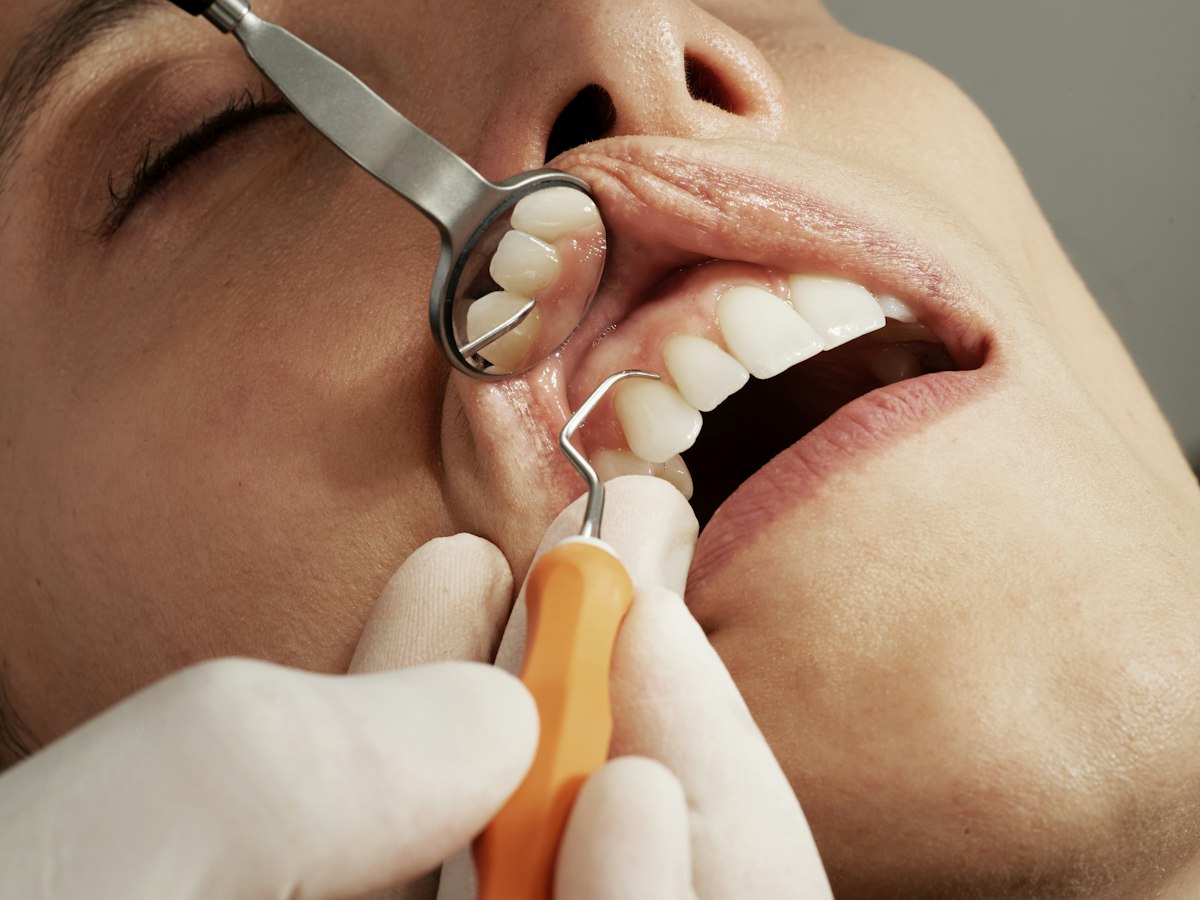 Dental examination